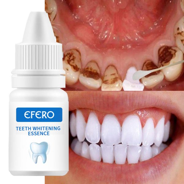 Teeth Whitening Oral Hygiene